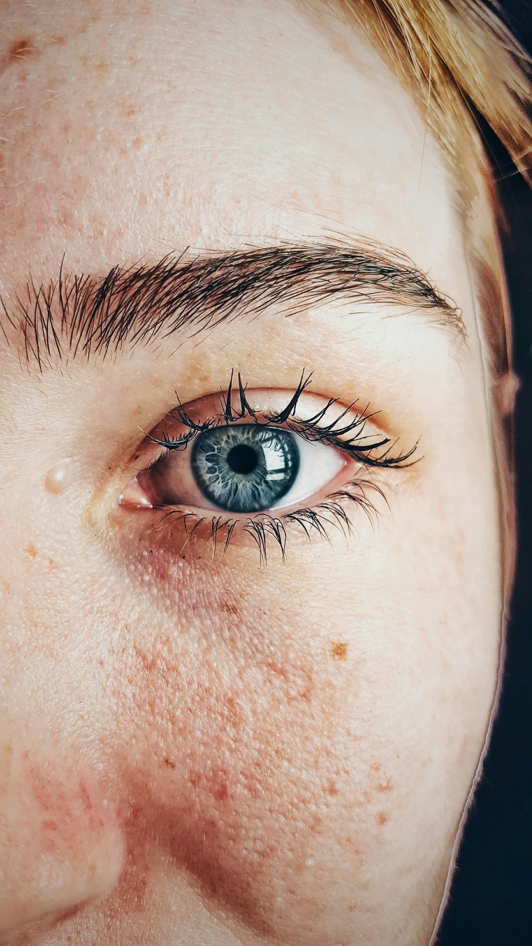 Ophthalmology